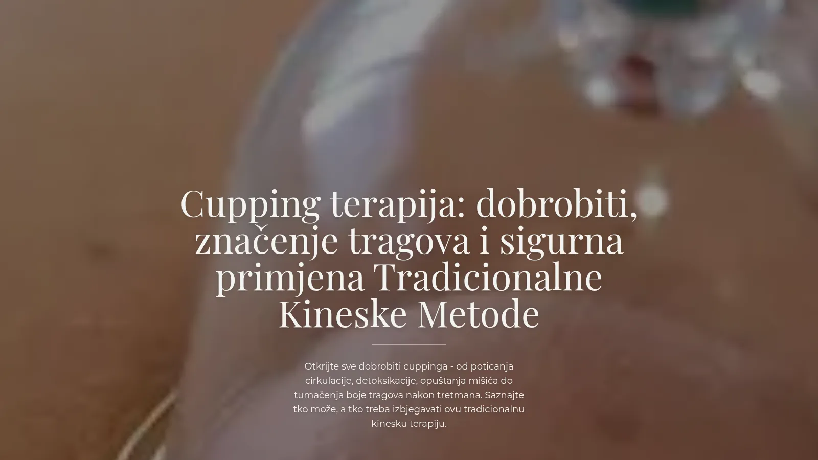 A Shuyuan blog post about cupping therapy